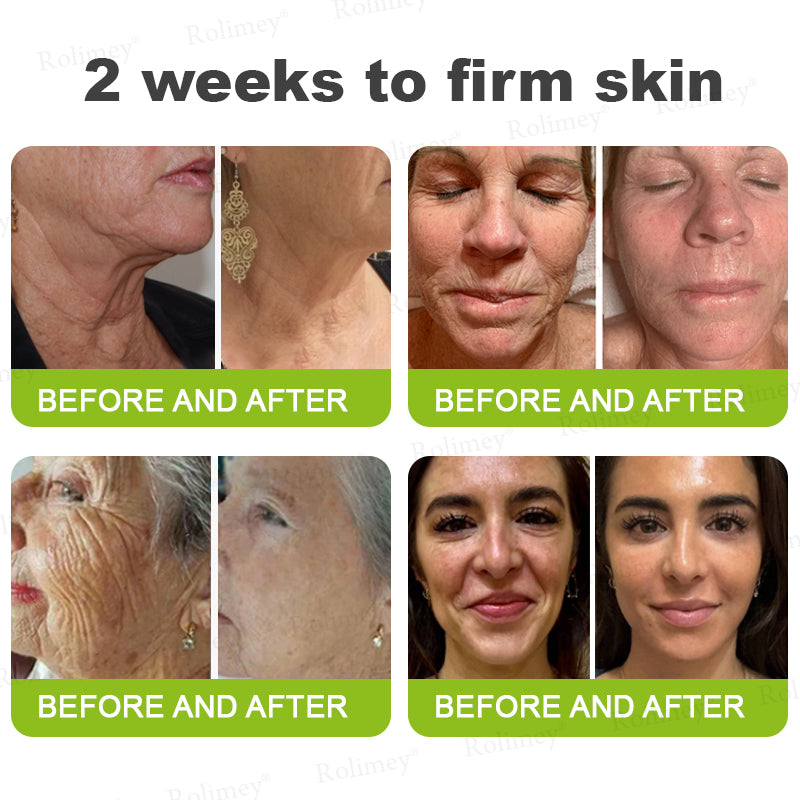 👨‍⚕️Made and shipped from Australia 💫Rolimey® Botox & Vita-A Retinol Shot Wrinkle-Lift Tightening cream - Last Day Promotion 70% OFF